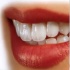 دریافت منظم فلوراید باعث كاهش پوسیدگی در دندان می شود؟